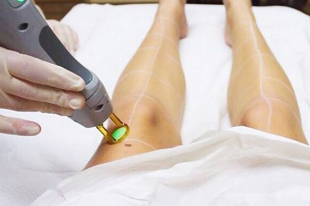 Clearfield Laser Hair Removal 
